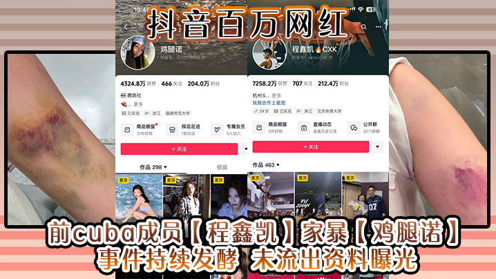 抖音百万网红前cuba成员程鑫凯家暴鸡腿诺事件持续发酵未流出资料曝光封面