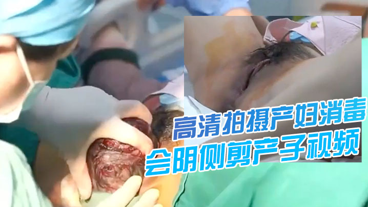 震撼流出高清拍摄产妇消毒会阴会阴侧剪产子视频流出分娩大赞妇科知识学习了女性的伟大封面