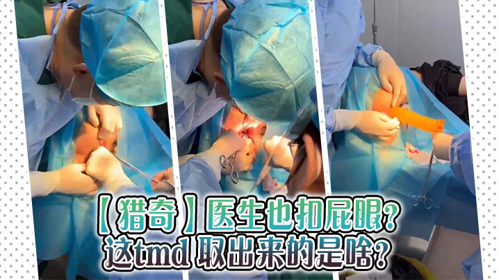 猎奇医生也扣屁眼这tmd取出来的是啥.封面